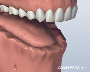 Before Screw Retained Denture